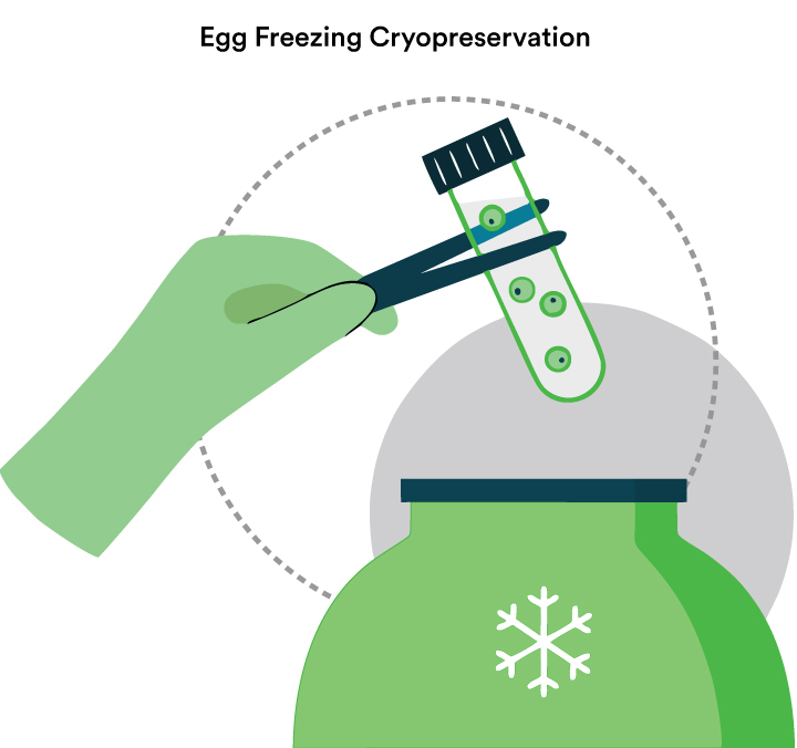 Cryopreservation