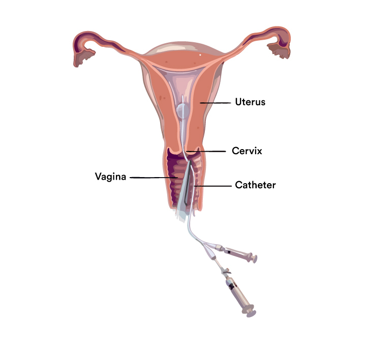 Female-Treatment